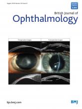 British Journal of Ophthalmology: 102 (8)